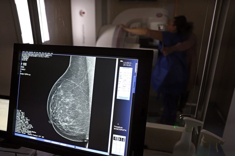 Ministério da Saúde passa a recomendar mamografia a partir dos 40 anos